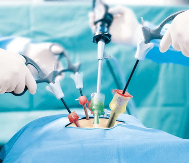 Modern laparoscopic and laser surgery operating theatre at Dr Abhilash Centre